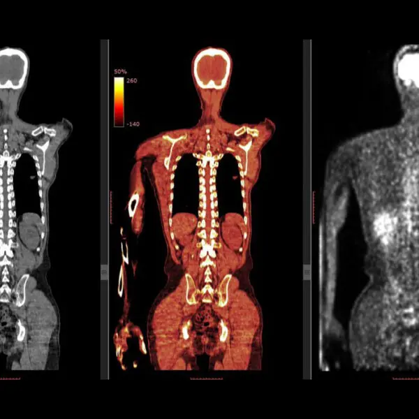 Advanced Imaging and Radiology Workshop: CTs, MRIs, PET, and More!