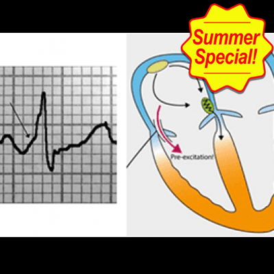12-Lead EKG Bundle