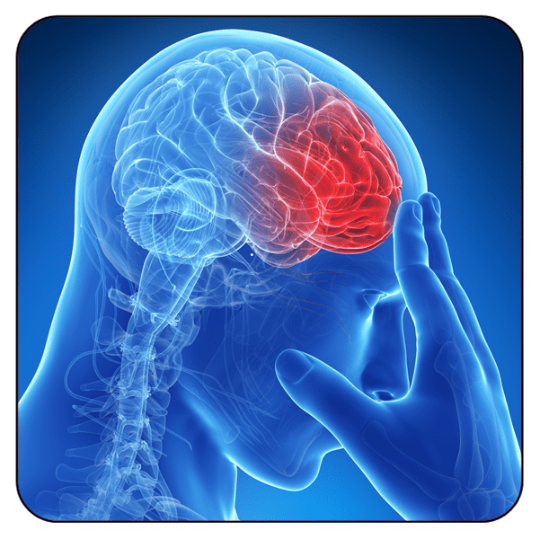 Time is Brain Or A STROKE of Bad Luck Renewal Barkley & Associates, Inc.