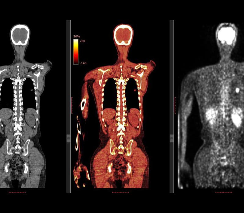 Advanced Imaging and Radiology Workshop: CTs, MRIs, PET, and More ...