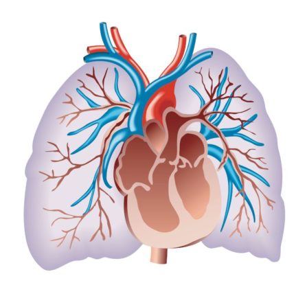 Pulmonary Hypertension