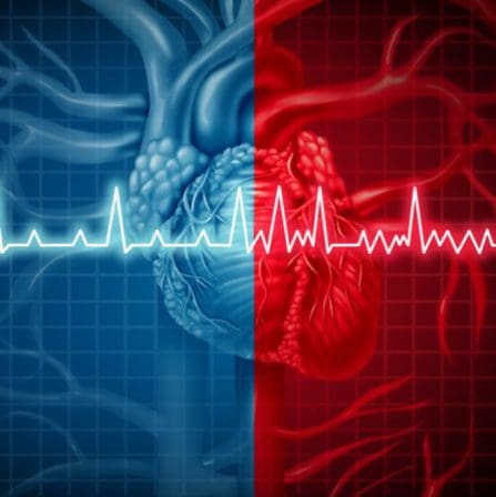 Atrial Fibrillation and Anticoagulation