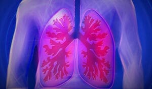 Thoracic-Respiratory Disorders