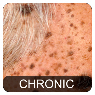 Dermatologic Disorders Chronic