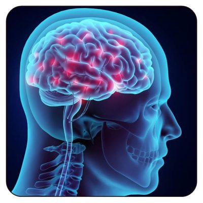 Neuro.Adult_.DDX