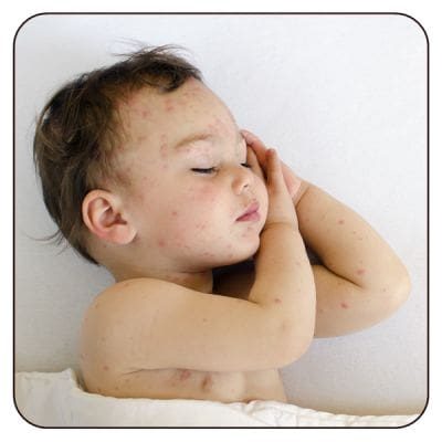 Pediatric-Dermatology