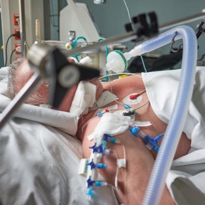 Intubated,Adult,White,Man,Under,Ventilator,Lying,In,Coma,In