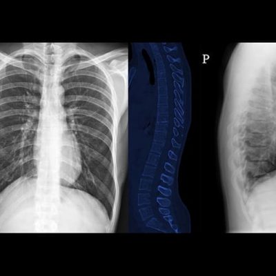 Radiology