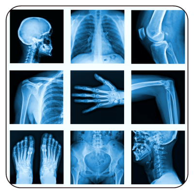 Radiology Review: From Novice to Expert