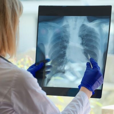 Doctor,Diagnoses,Health,Status,Of,Patient,With,Asthma,,Lung,Diseases