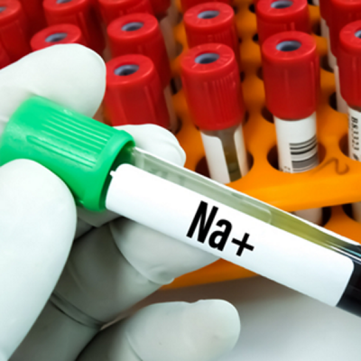 Sodium imbalances